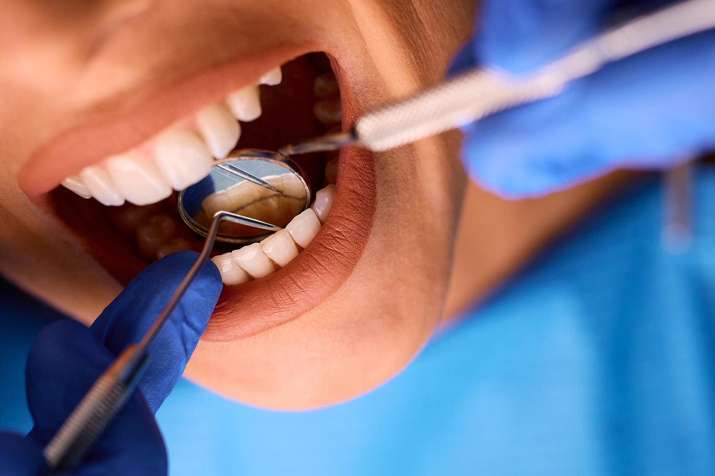 Professional dental cleaning at Desert Family Dental Mesa AZ